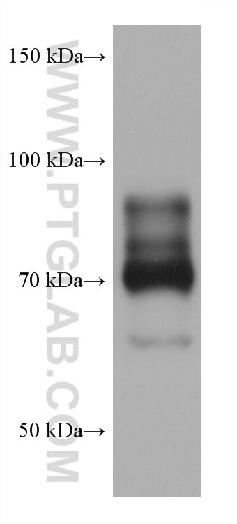 Western Blot (WB) analysis of Karpas-422 cells using SIGLEC10 Monoclonal antibody (60547-1-Ig)