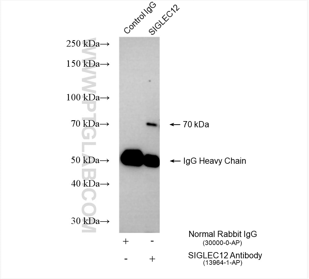 Siglec-12