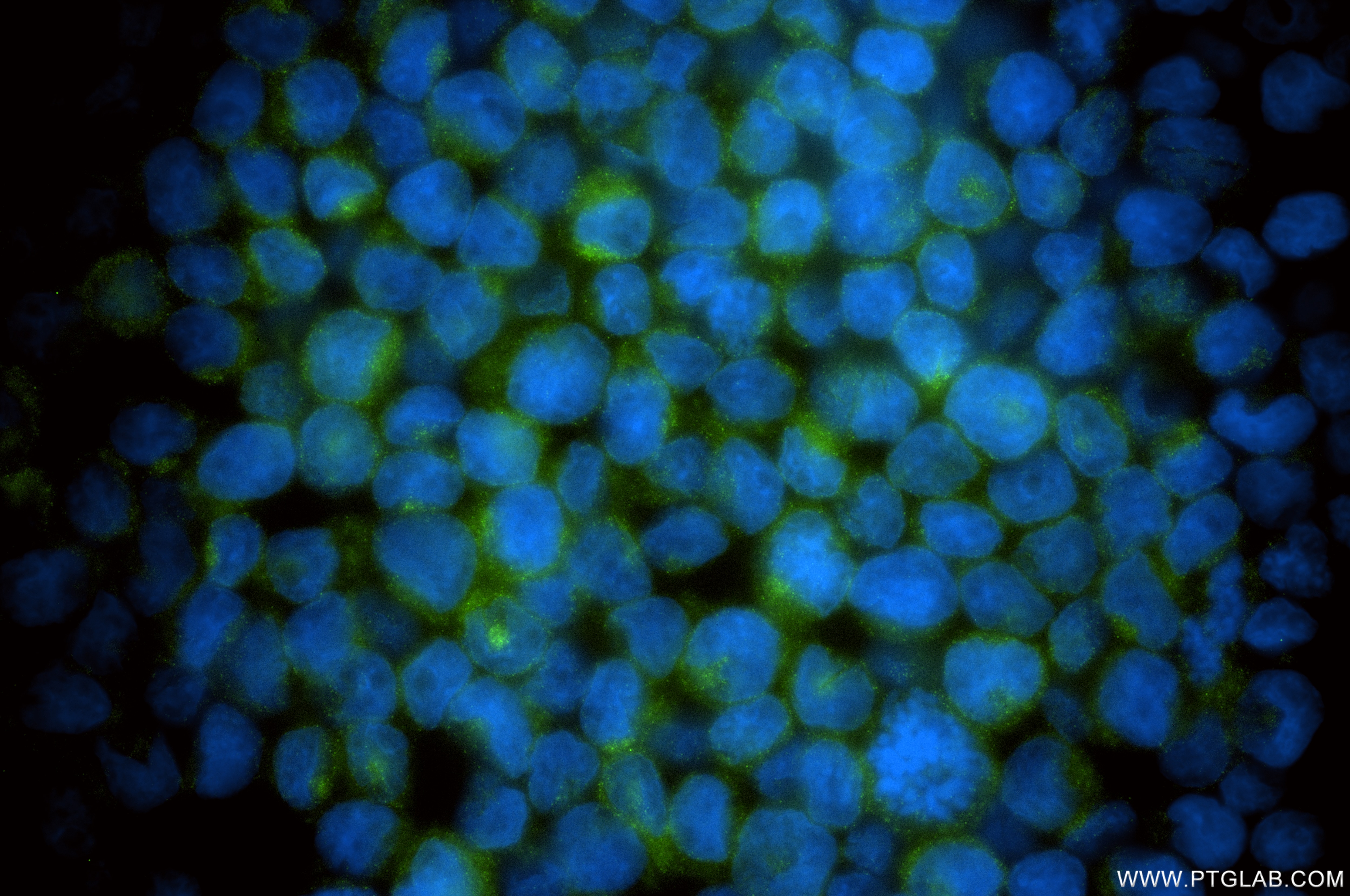 Immunofluorescence (IF) / fluorescent staining of U-937 cells using SIGLEC14 Recombinant monoclonal antibody (86628-3-RR)