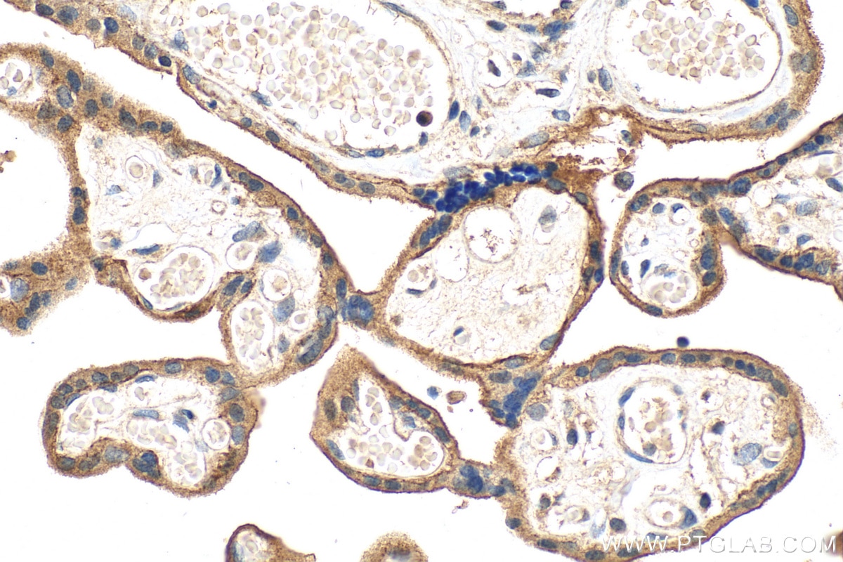 IHC staining of human placenta using 13454-1-AP