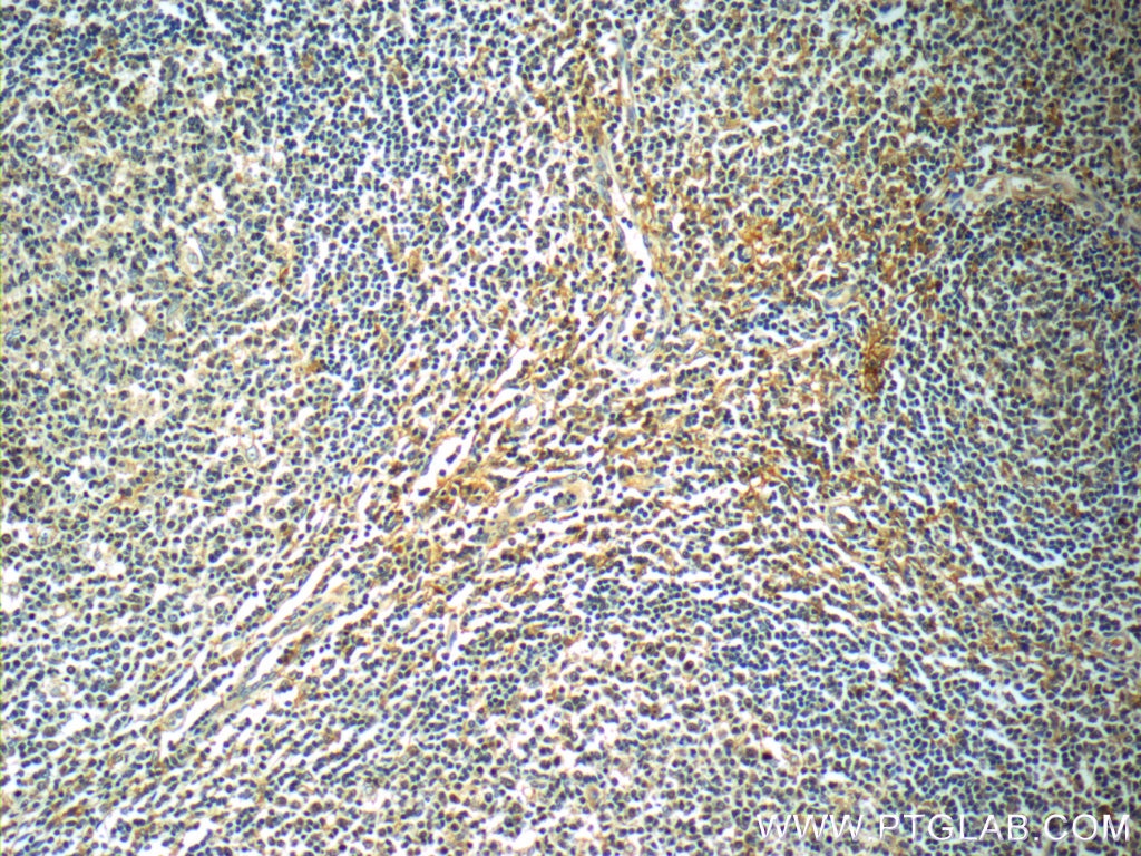 Immunohistochemistry (IHC) staining of human tonsillitis tissue using Siglec-7 Polyclonal antibody (13939-1-AP)