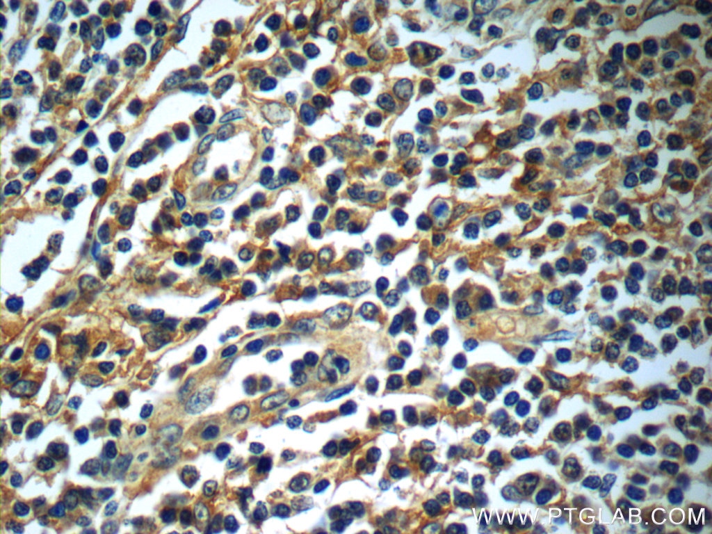Immunohistochemistry (IHC) staining of human tonsillitis tissue using Siglec-7 Polyclonal antibody (13939-1-AP)