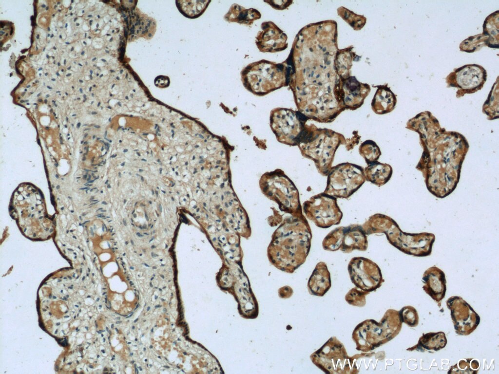 IHC staining of human placenta using 13939-1-AP