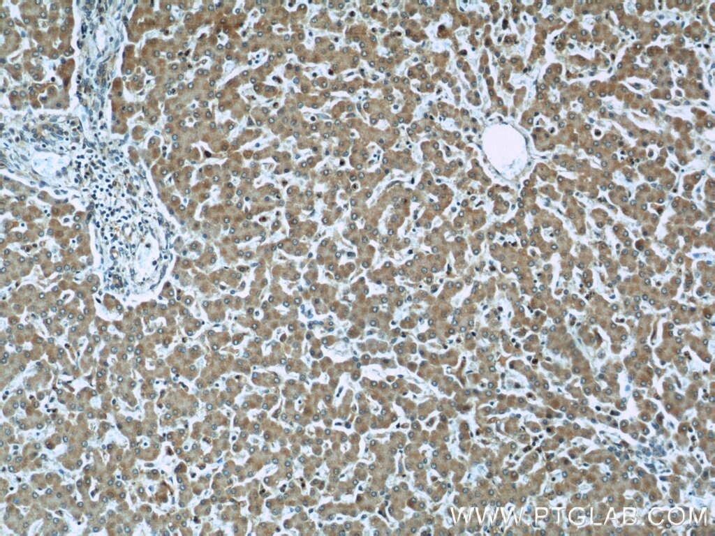Immunohistochemistry (IHC) staining of human liver tissue using Siglec-7 Polyclonal antibody (13939-1-AP)