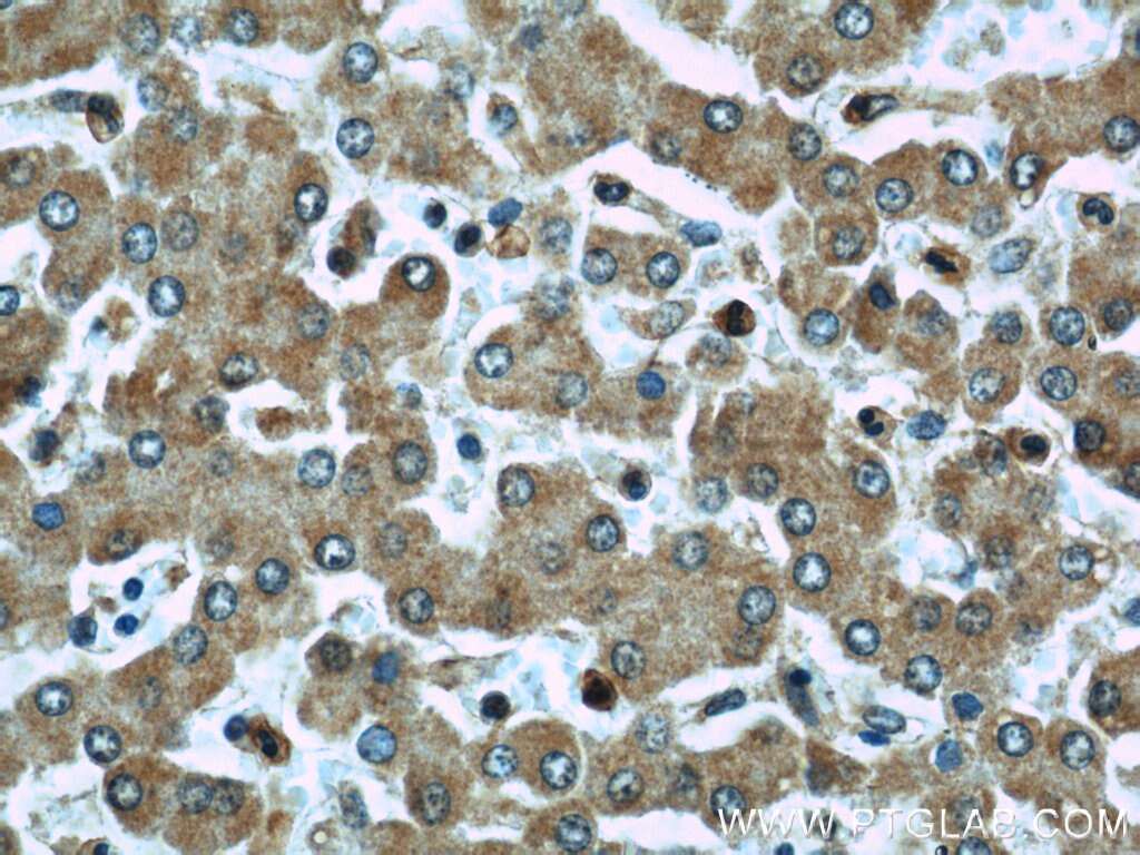 Immunohistochemistry (IHC) staining of human liver tissue using Siglec-7 Polyclonal antibody (13939-1-AP)