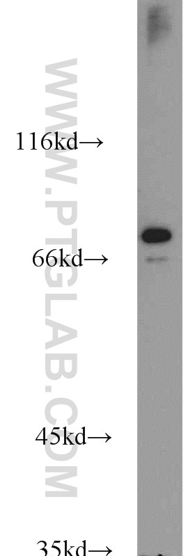 Western Blot (WB) analysis of human liver tissue using Siglec-7 Polyclonal antibody (13939-1-AP)