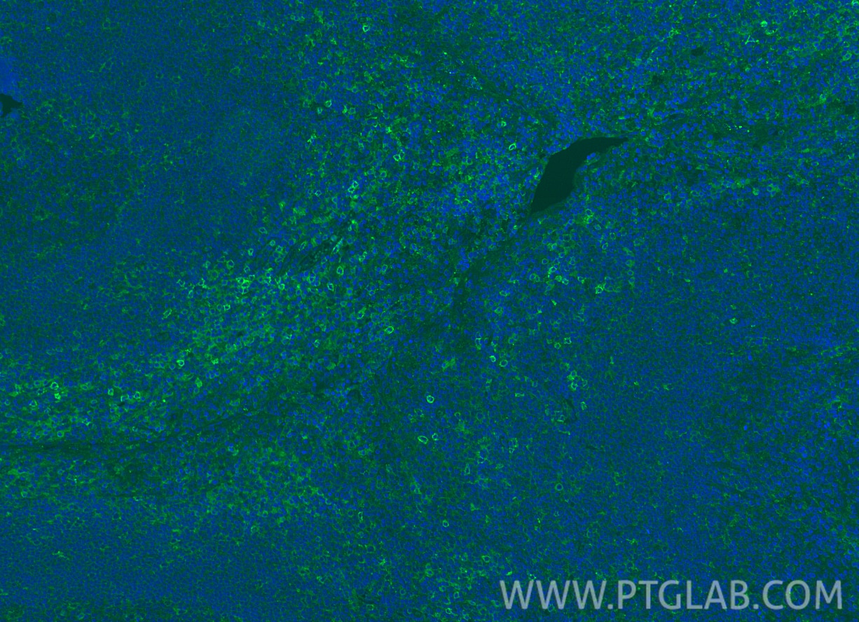 Immunofluorescence (IF) / fluorescent staining of human tonsillitis tissue using Siglec-9 Polyclonal antibody (13377-1-AP)