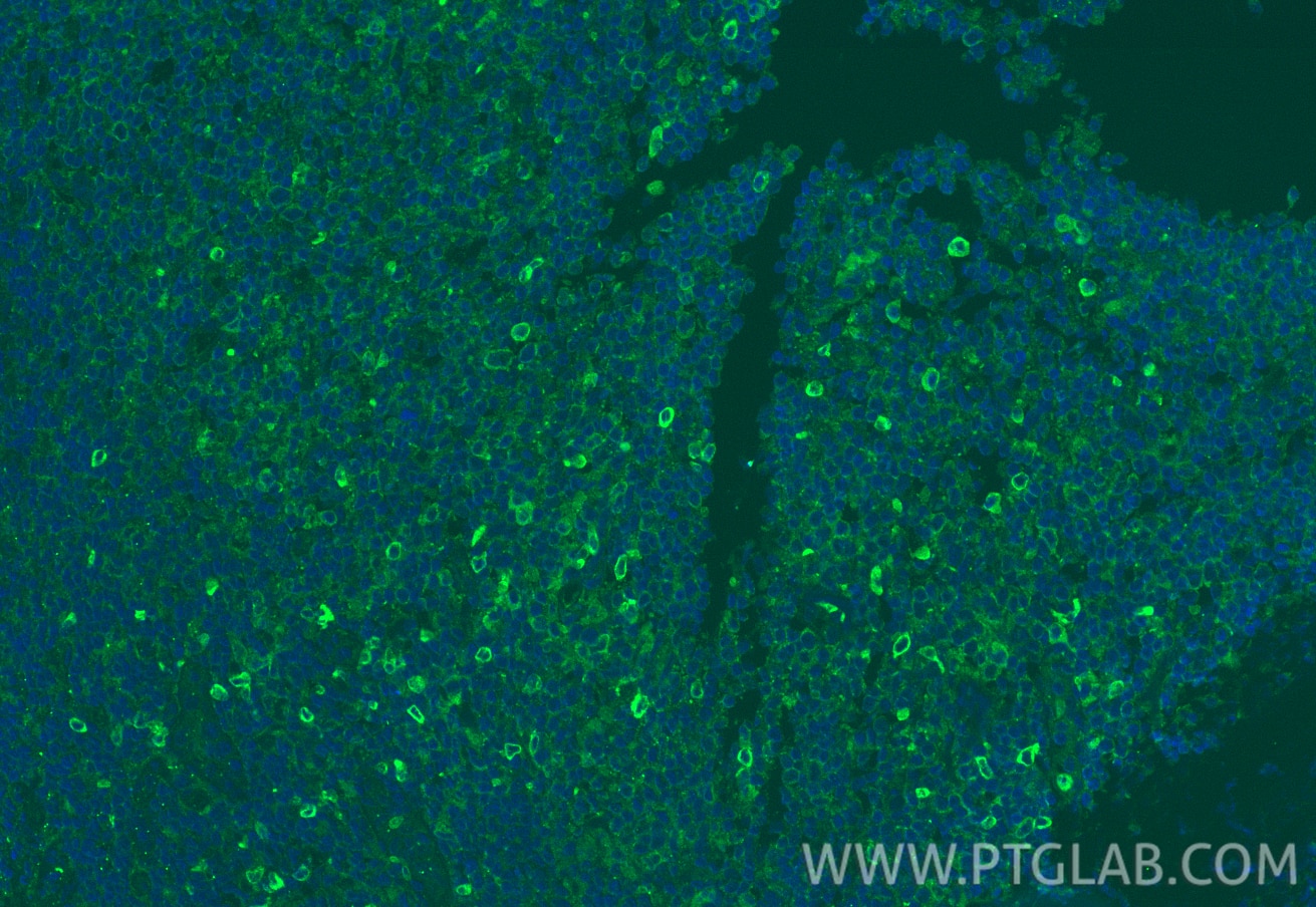 Immunofluorescence (IF) / fluorescent staining of human tonsillitis tissue using Siglec-9 Polyclonal antibody (13377-1-AP)