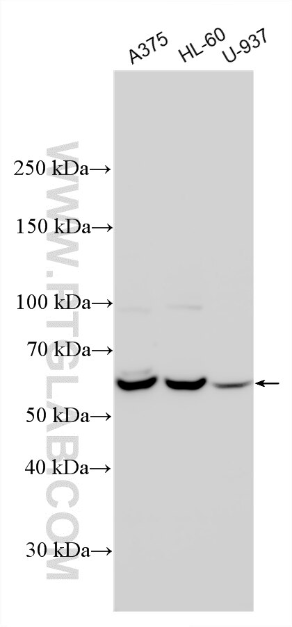 Western Blot (WB) analysis of various lysates using Siglec-9 Polyclonal antibody (13377-1-AP)