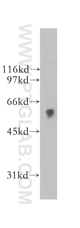 Western Blot (WB) analysis of U-937 cells using Siglec-9 Polyclonal antibody (13377-1-AP)