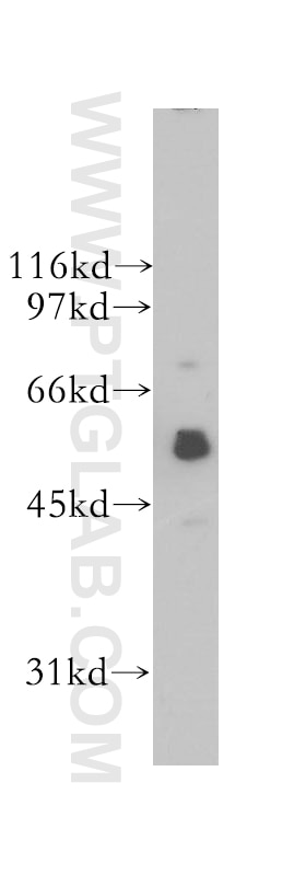 Western Blot (WB) analysis of A375 cells using Siglec-9 Polyclonal antibody (13377-1-AP)