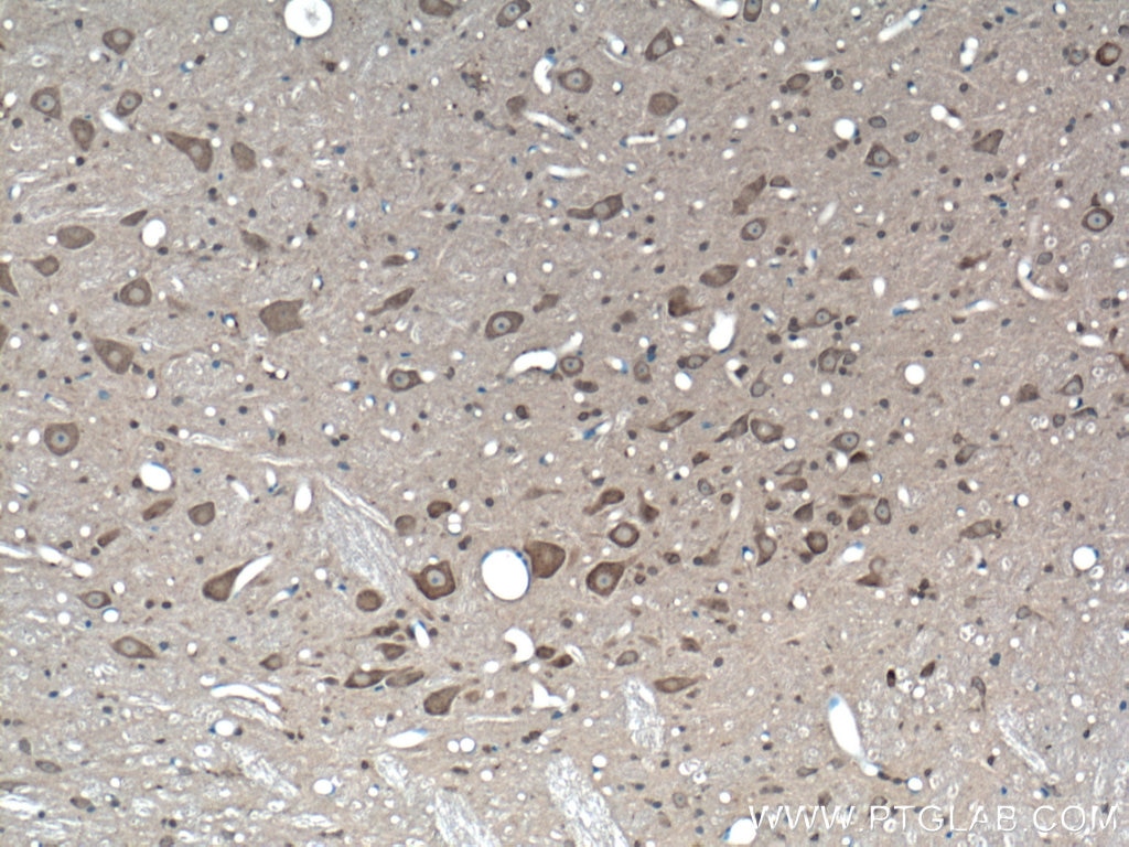 Immunohistochemistry (IHC) staining of rat brain tissue using SIGMAR1 Polyclonal antibody (15168-1-AP)