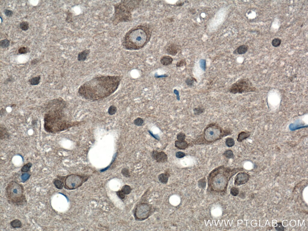 Immunohistochemistry (IHC) staining of rat brain tissue using SIGMAR1 Polyclonal antibody (15168-1-AP)