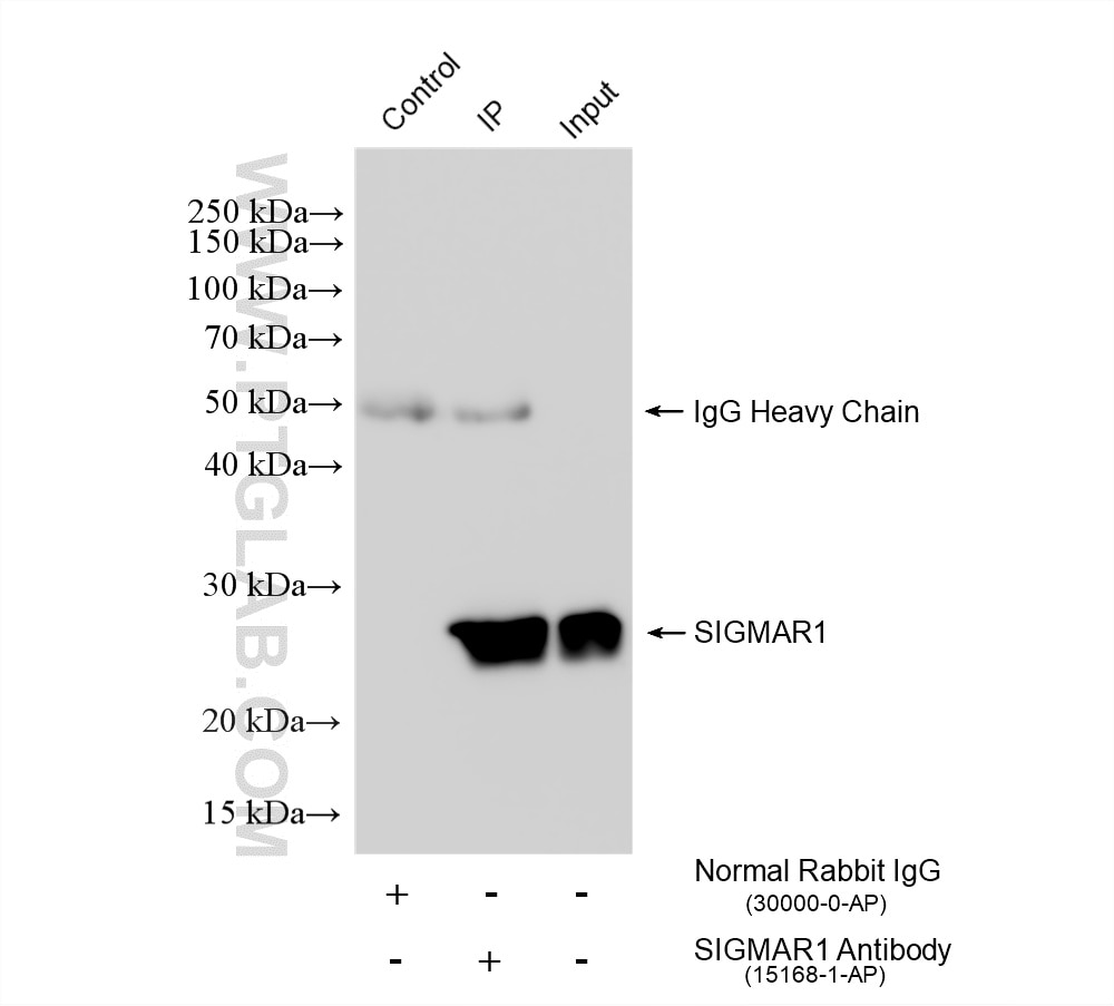 IP experiment of HEK-293 using 15168-1-AP Immunoprecipitation (IP) experiment of HEK-293 cells using SIGMAR1 Polyclonal antibody (15168-1-AP)