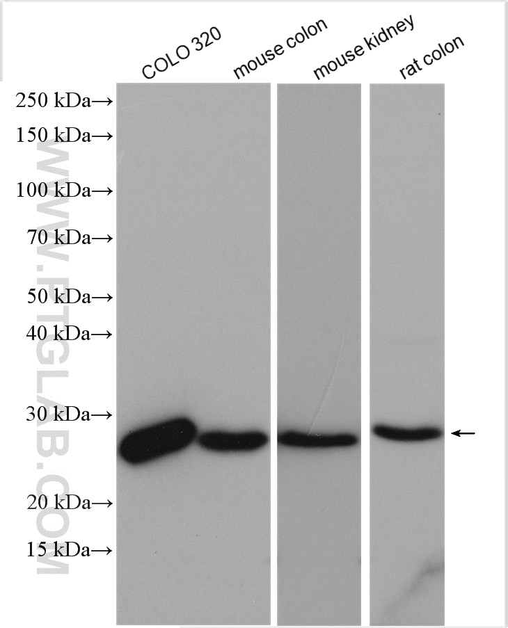 Western Blot (WB) analysis of various lysates using SIGMAR1 Polyclonal antibody (15168-1-AP)