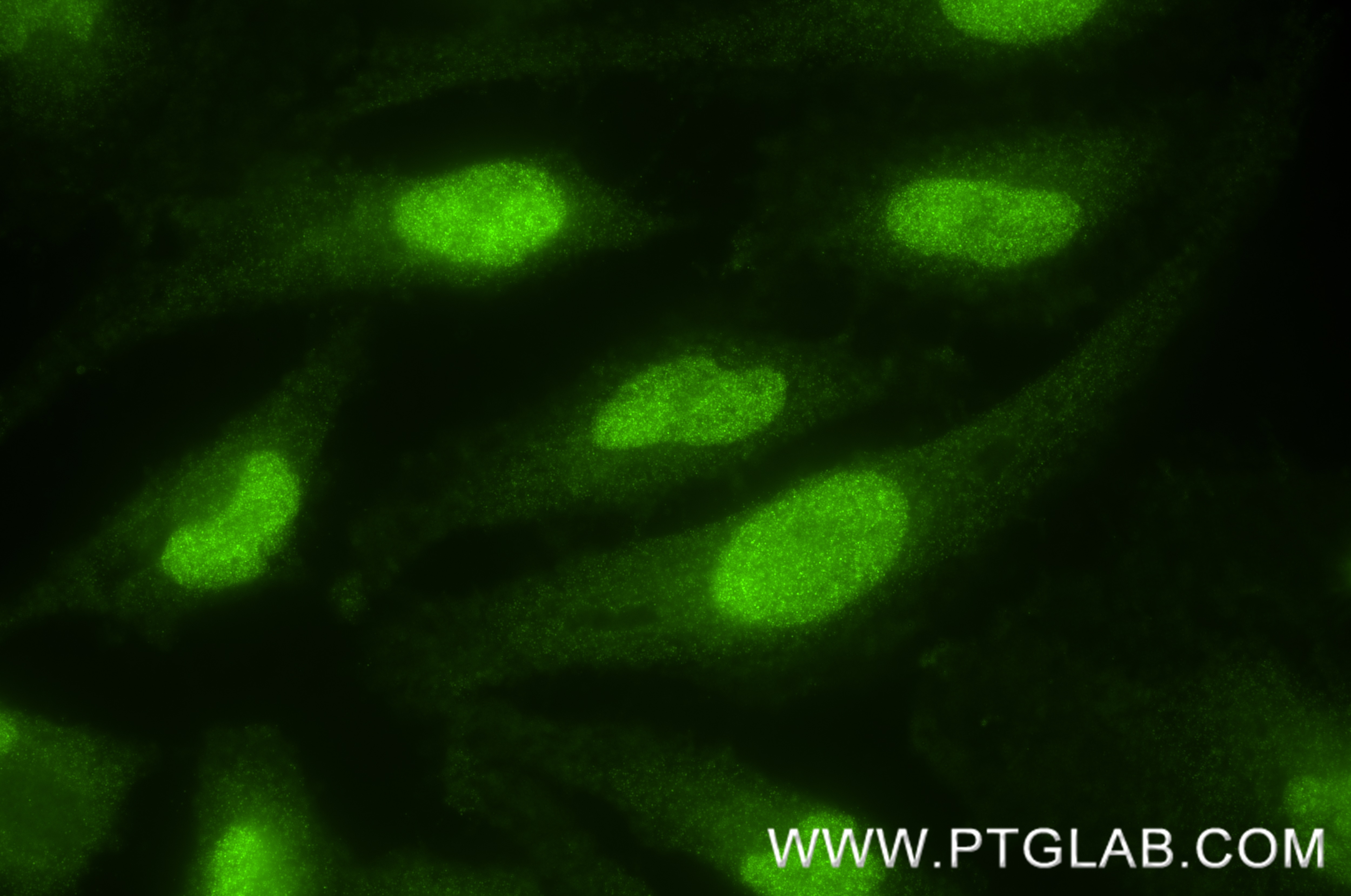 IF Staining of HeLa using 85064-1-RR (same clone as 85064-1-PBS) Immunofluorescence (IF) / fluorescent staining of HeLa cells using SIGMAR1 Recombinant monoclonal antibody (85064-1-RR)