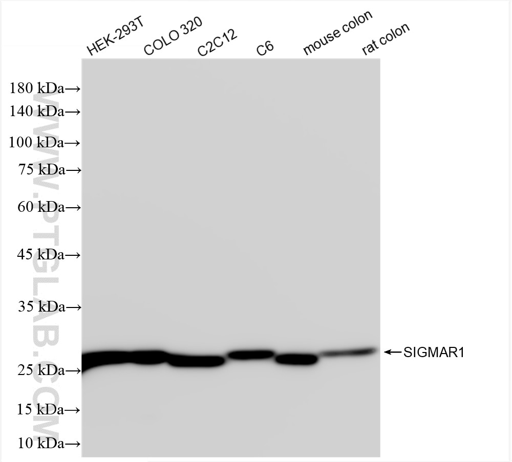 Western Blot (WB) analysis of various lysates using SIGMAR1 Recombinant antibody (85064-1-RR)