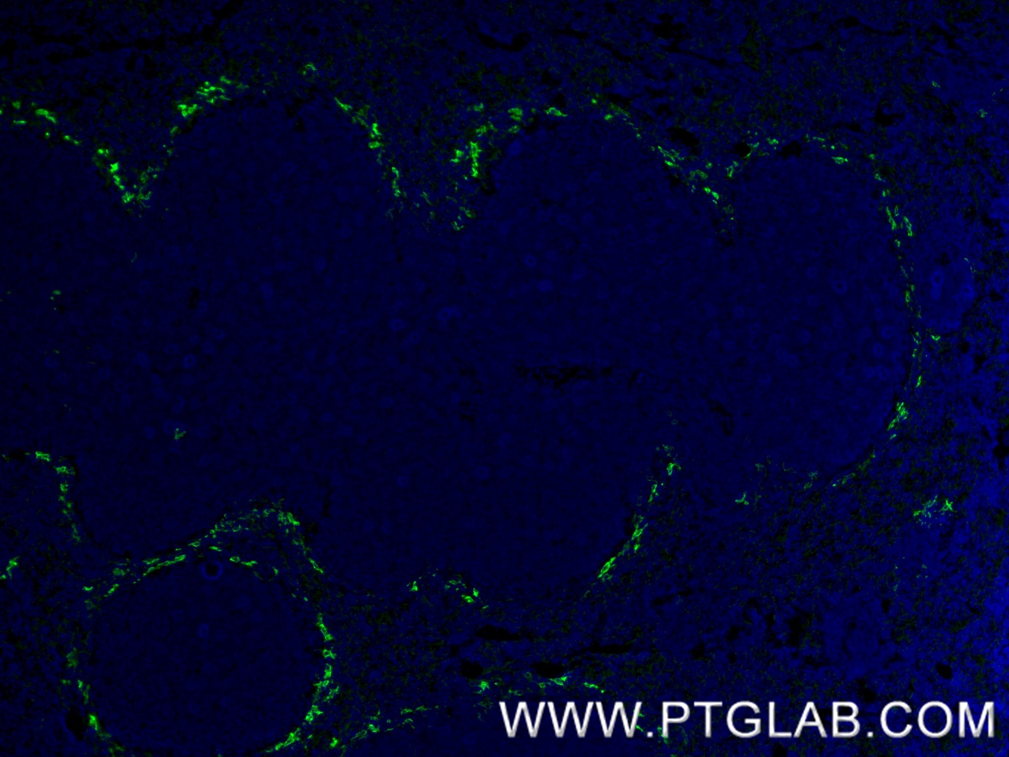 Immunofluorescence (IF) / fluorescent staining of mouse spleen tissue using SIGNR1/CD209b Recombinant antibody (84365-5-RR)