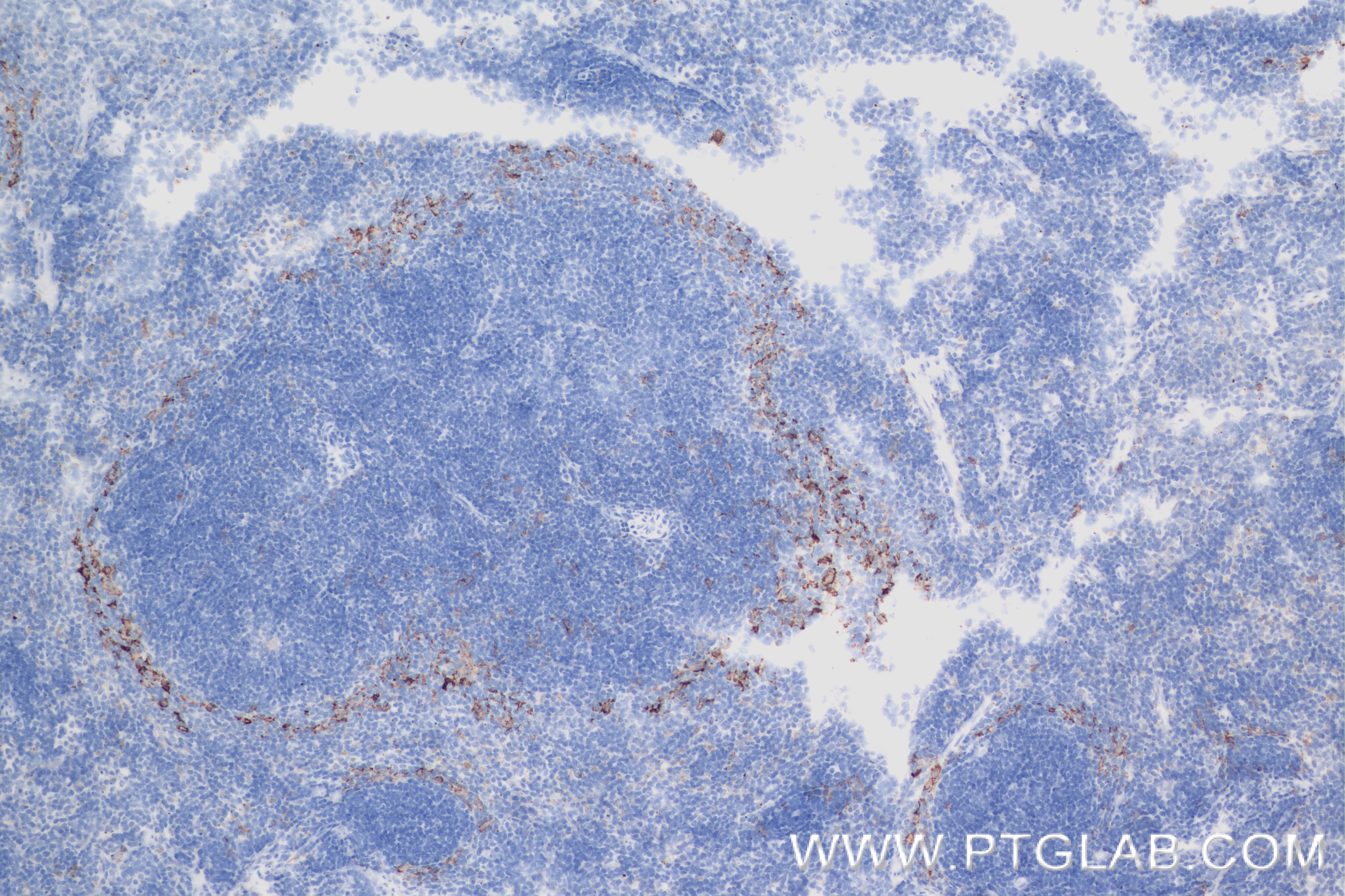 Immunohistochemistry (IHC) staining of mouse spleen tissue using SIGNR1/CD209b Recombinant antibody (84365-5-RR)