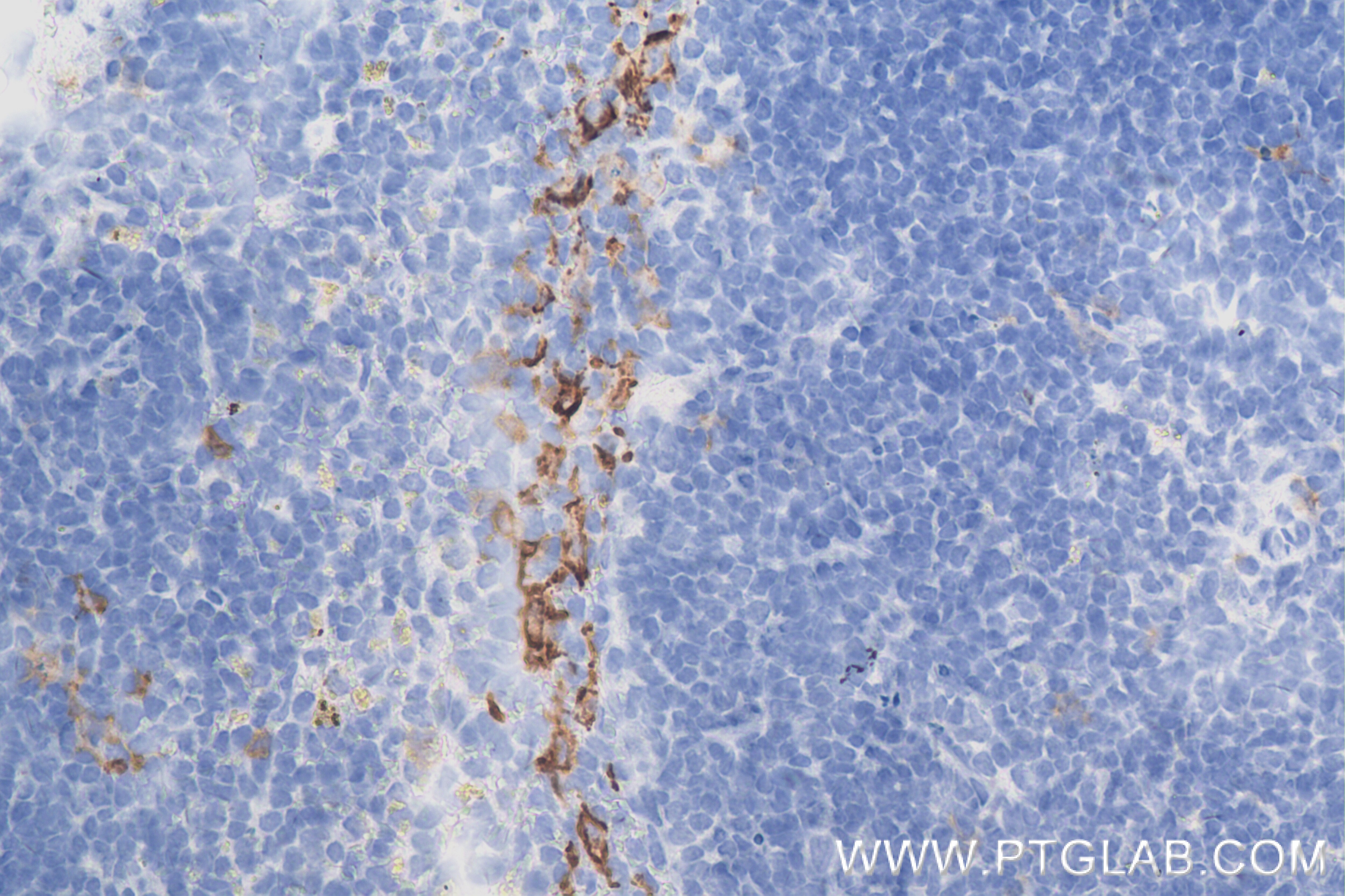 Immunohistochemistry (IHC) staining of mouse spleen tissue using SIGNR1/CD209b Recombinant antibody (84365-5-RR)