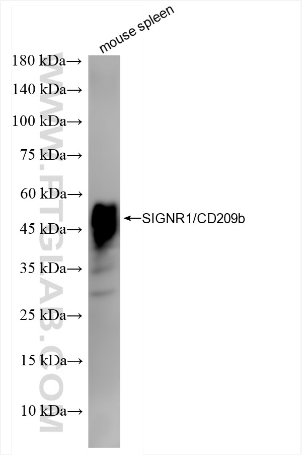 Western Blot (WB) analysis of mouse spleen tissue using SIGNR1/CD209b Recombinant antibody (84365-5-RR)