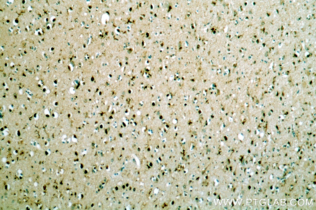 Immunohistochemistry (IHC) staining of human brain tissue using TCEA1 Polyclonal antibody (17825-1-AP)