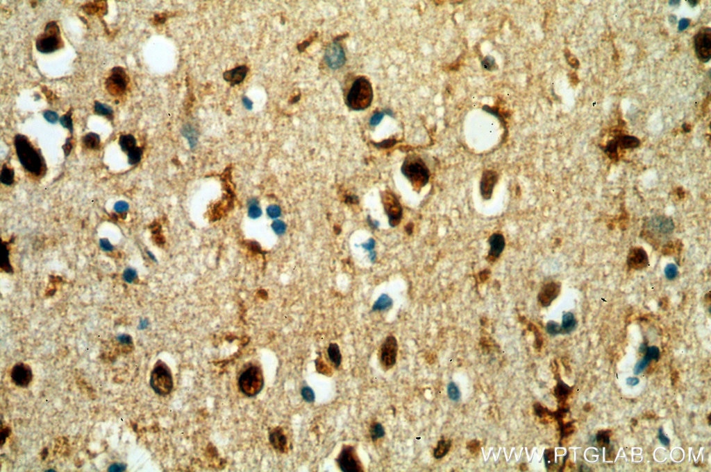 Immunohistochemistry (IHC) staining of human brain tissue using TCEA1 Polyclonal antibody (17825-1-AP)