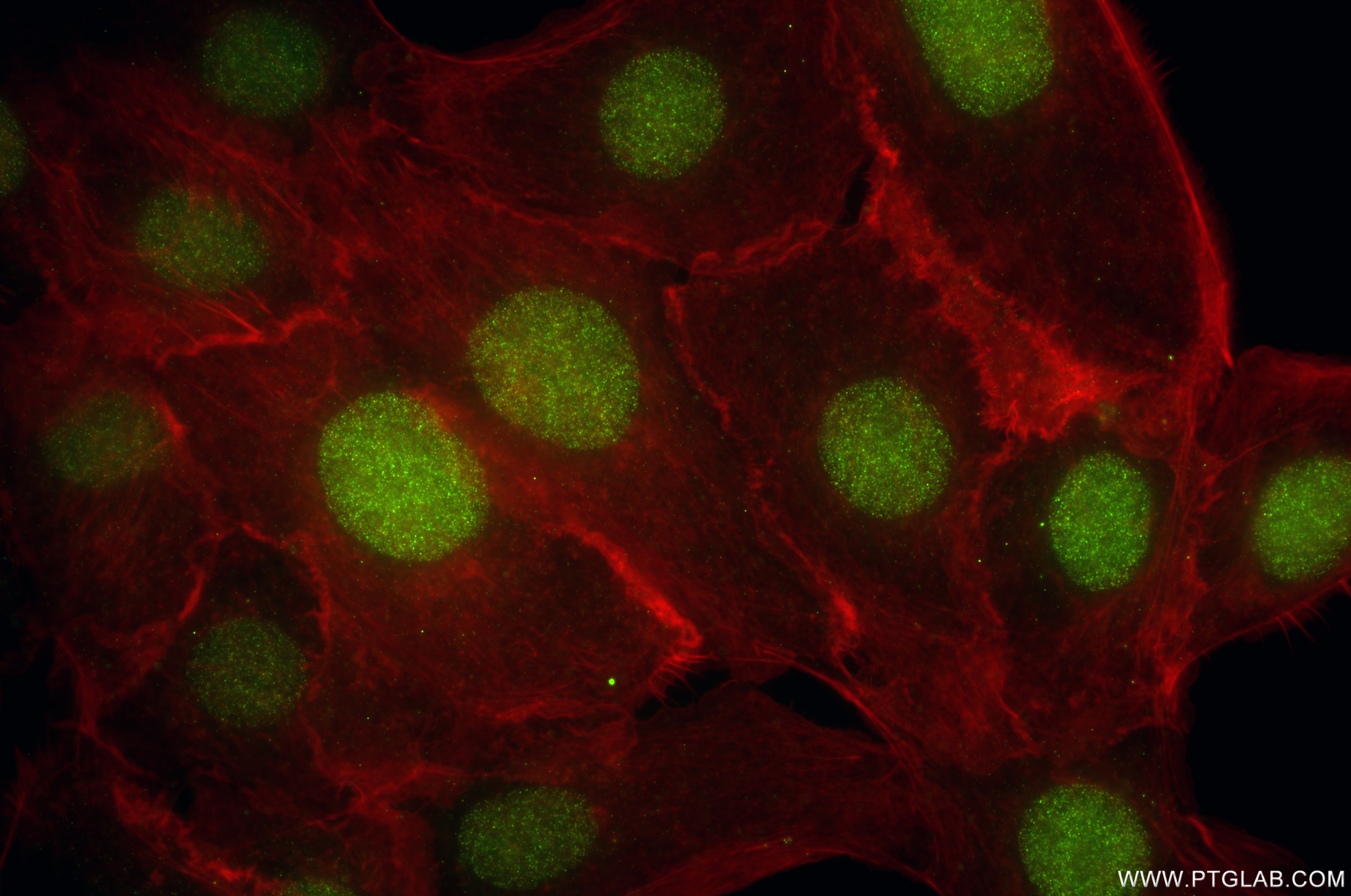 Immunofluorescence (IF) / fluorescent staining of A431 cells using SII-TFIIS,TCEA1 Recombinant antibody (85664-4-RR)