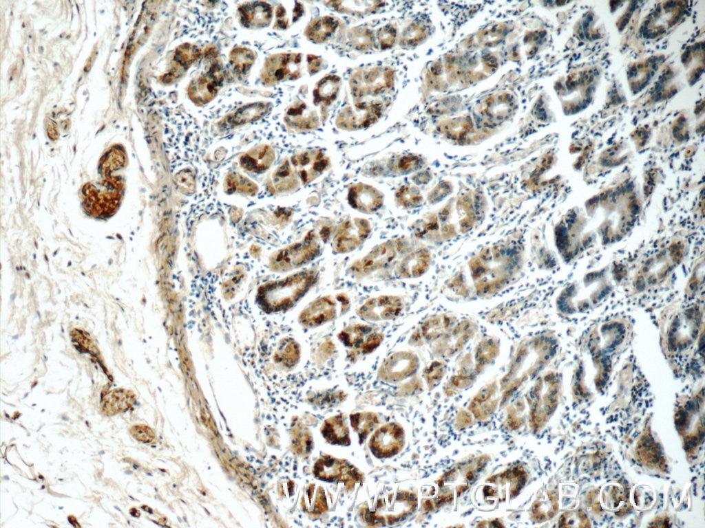 Immunohistochemistry (IHC) staining of human stomach tissue using SIK1 Polyclonal antibody (17370-1-AP)