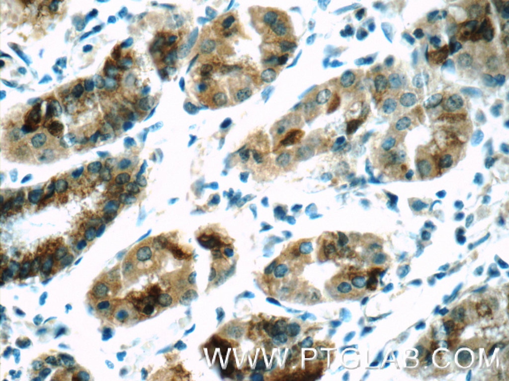 IHC staining of human stomach using 17370-1-AP