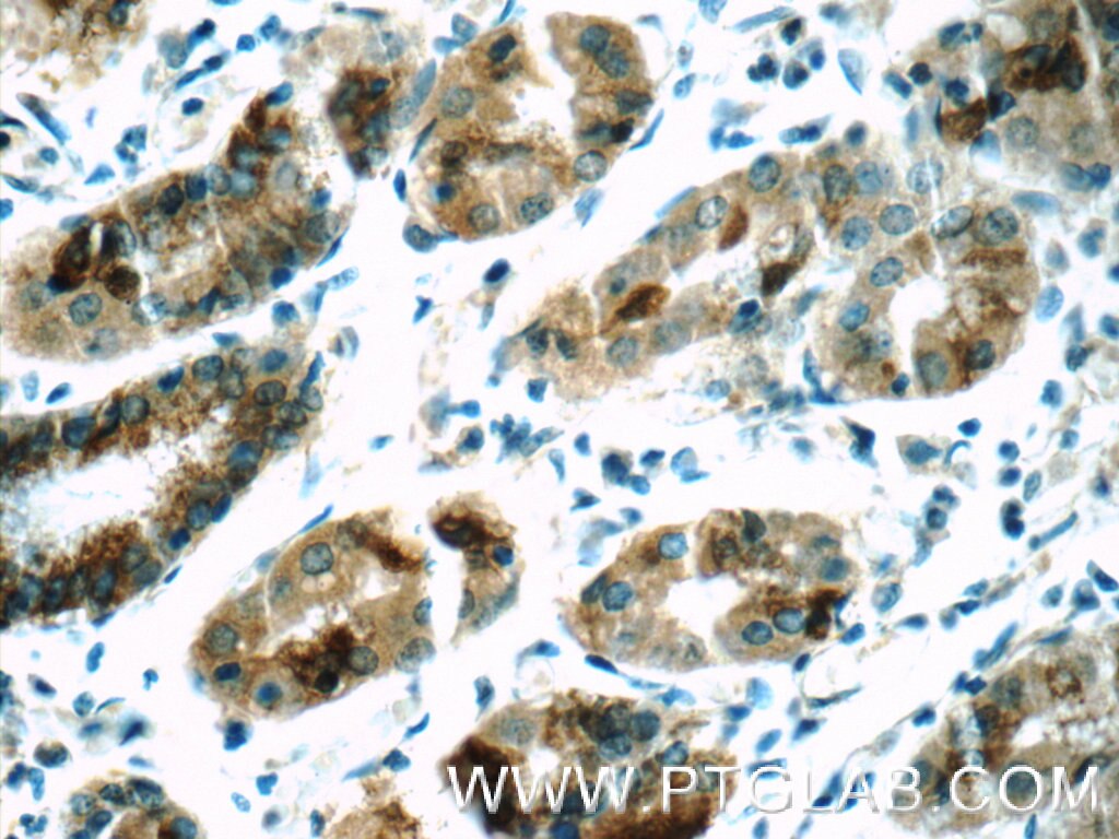 Immunohistochemistry (IHC) staining of human stomach tissue using SIK1 Polyclonal antibody (17370-1-AP)