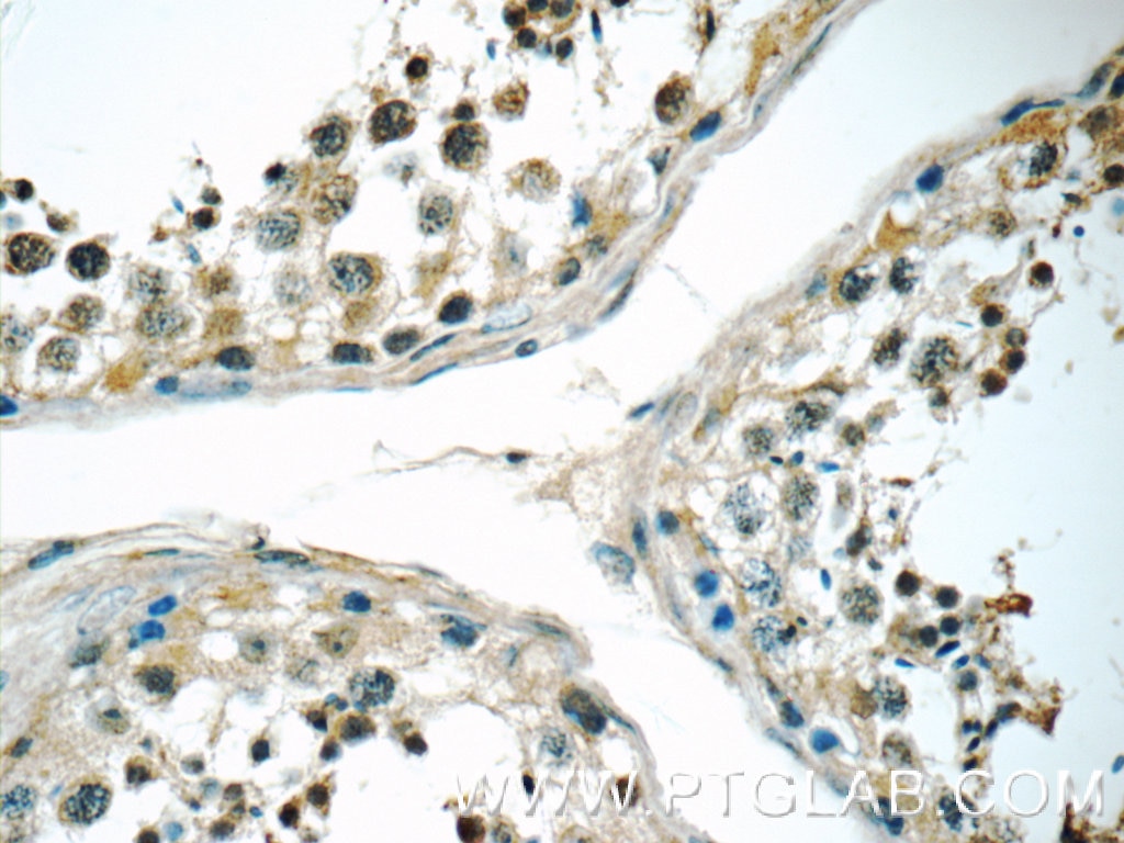 Immunohistochemistry (IHC) staining of human testis tissue using SIK1 Polyclonal antibody (17370-1-AP)