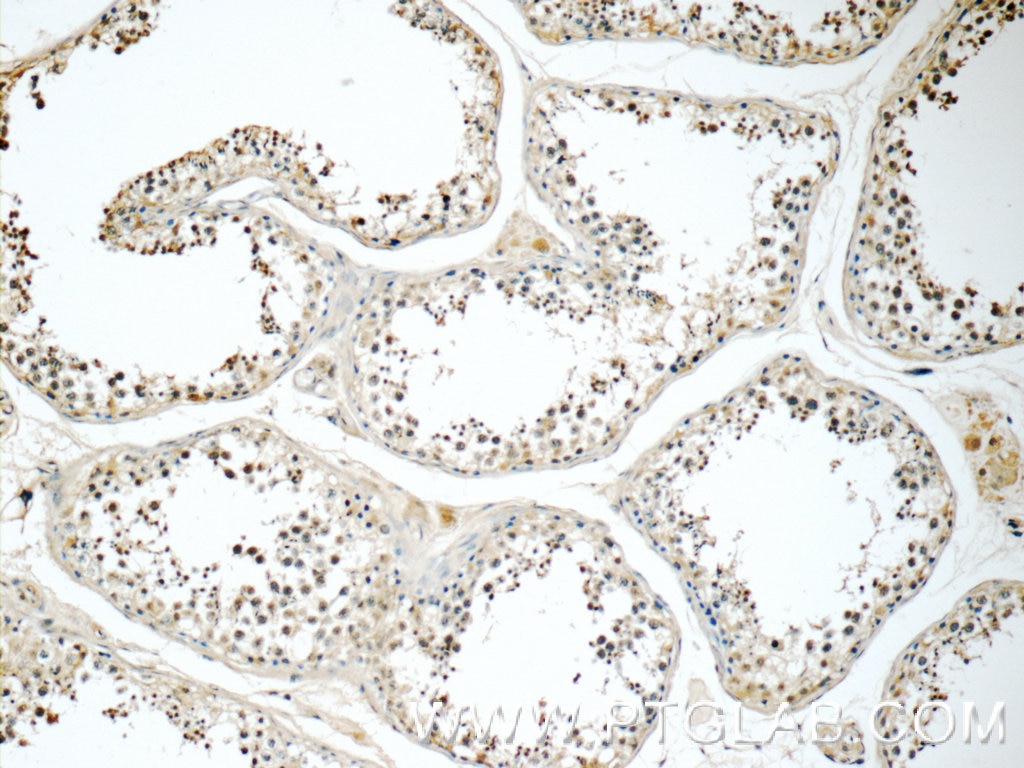 Immunohistochemistry (IHC) staining of human testis tissue using SIK1 Polyclonal antibody (17370-1-AP)