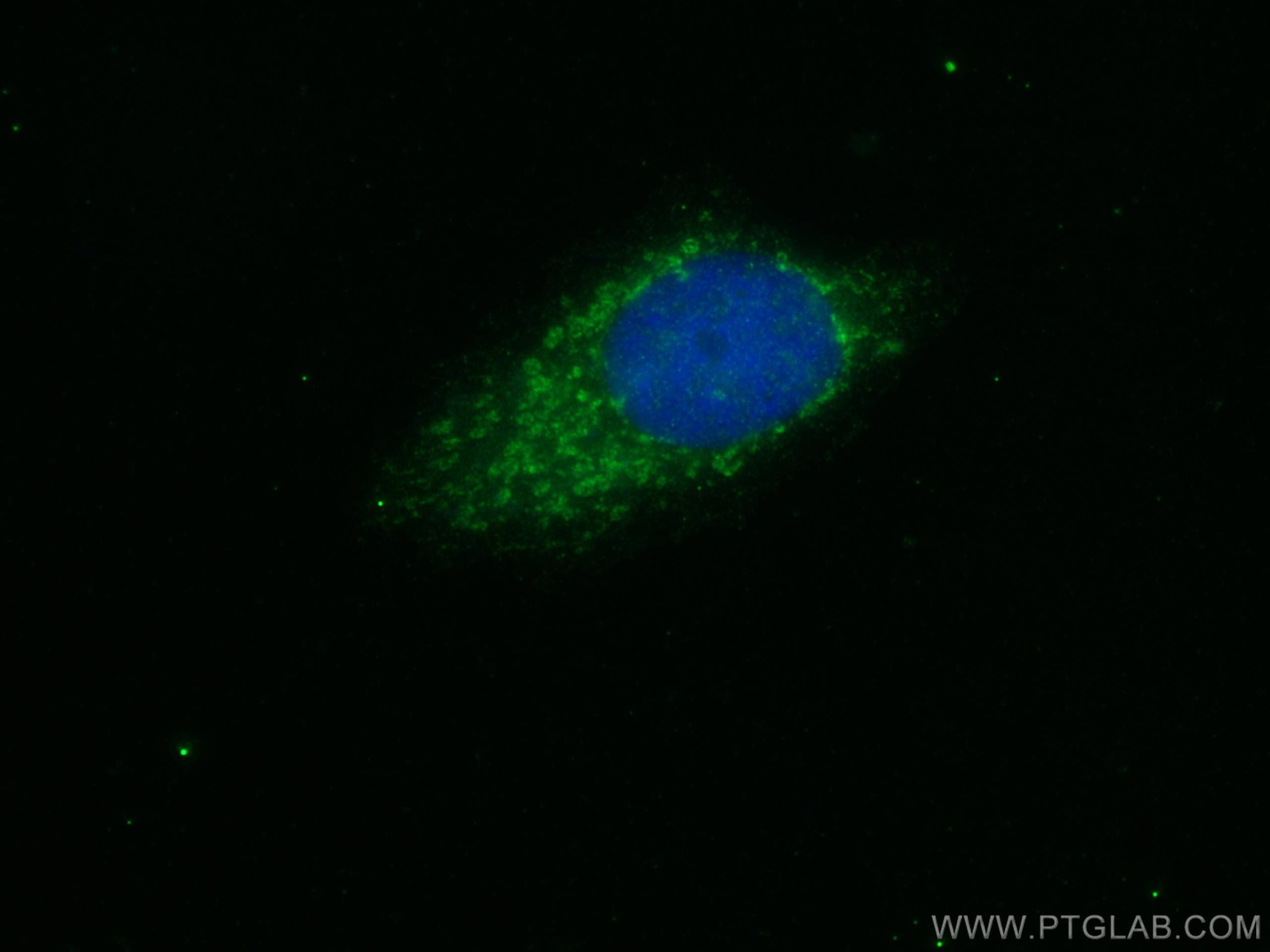 Immunofluorescence (IF) / fluorescent staining of MCF-7 cells using Snf1lk Polyclonal antibody (51045-1-AP)
