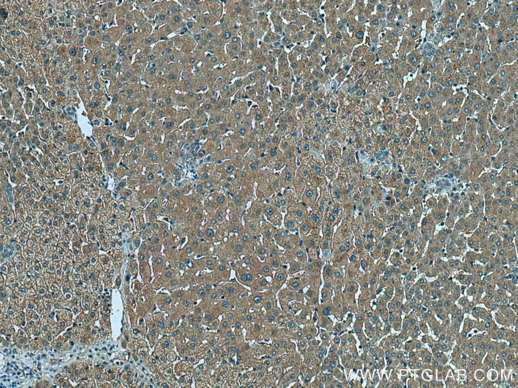 Immunohistochemistry (IHC) staining of human liver tissue using Snf1lk Polyclonal antibody (51045-1-AP)