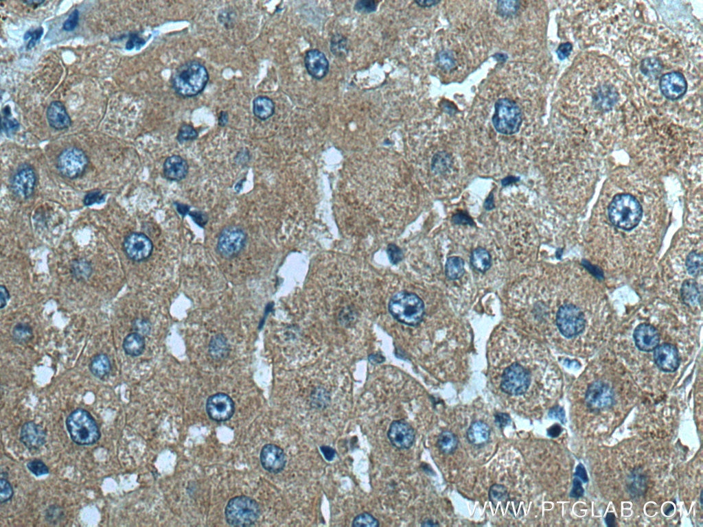 Immunohistochemistry (IHC) staining of human liver tissue using Snf1lk Polyclonal antibody (51045-1-AP)