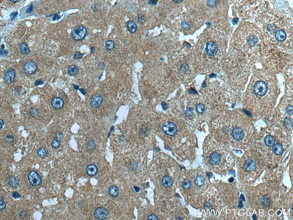 Immunohistochemistry (IHC) staining of human liver tissue using SIK1 Polyclonal antibody (51045-1-AP)