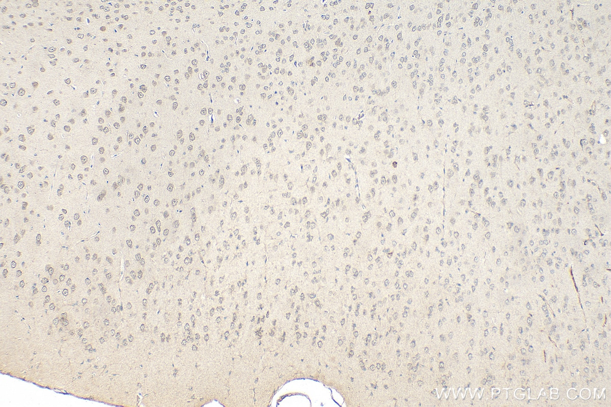IHC staining of mouse brain using 51045-1-AP