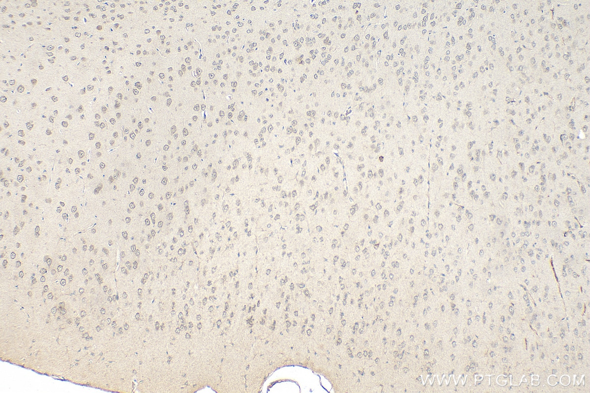 Immunohistochemistry (IHC) staining of mouse brain tissue using Snf1lk Polyclonal antibody (51045-1-AP)