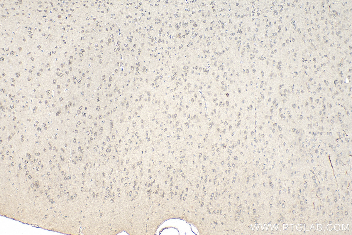 Immunohistochemistry (IHC) staining of mouse brain tissue using SIK1 Polyclonal antibody (51045-1-AP)