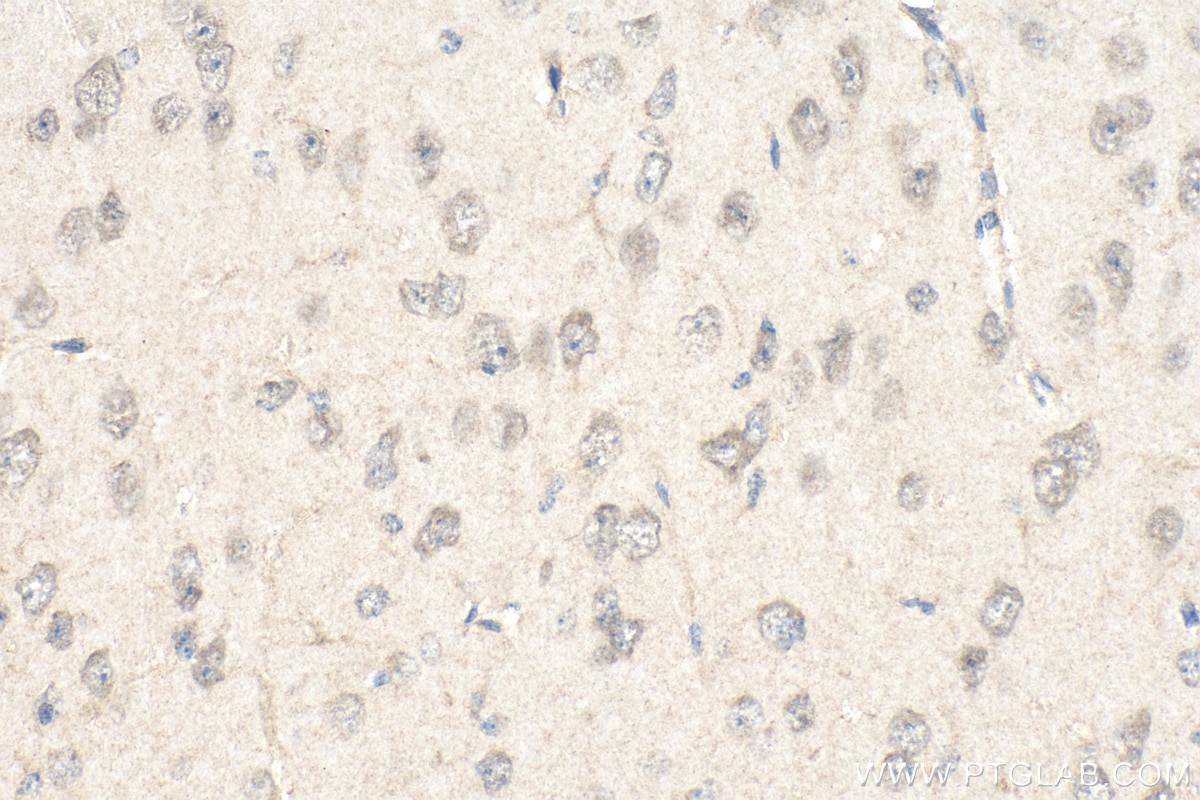 Immunohistochemistry (IHC) staining of mouse brain tissue using SIK1 Polyclonal antibody (51045-1-AP)