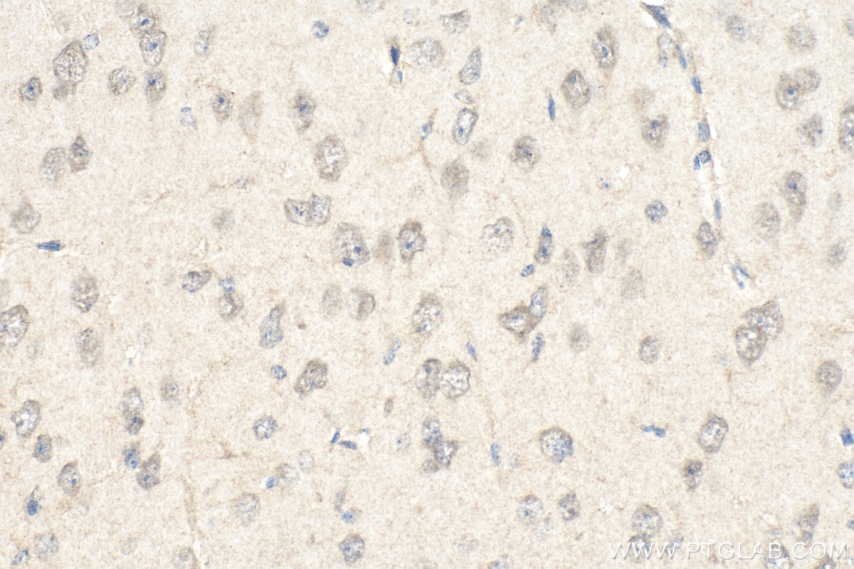 Immunohistochemistry (IHC) staining of mouse brain tissue using Snf1lk Polyclonal antibody (51045-1-AP)