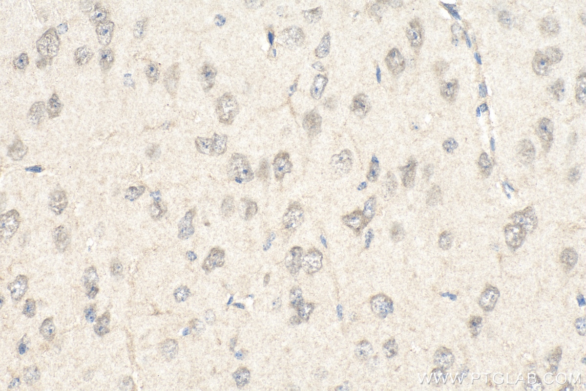 IHC staining of mouse brain using 51045-1-AP