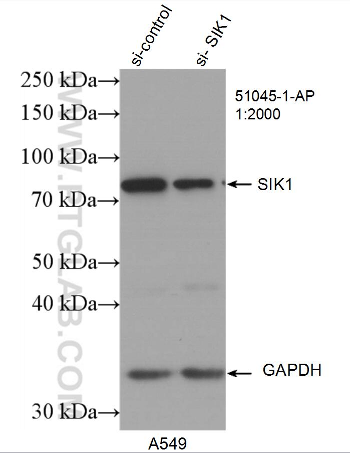 Western Blot (WB) analysis of A549 cells using SIK1 Polyclonal antibody (51045-1-AP)