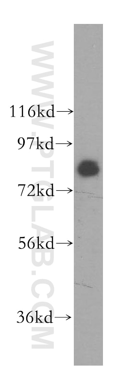 Western Blot (WB) analysis of A549 cells using SIK1 Polyclonal antibody (51045-1-AP)