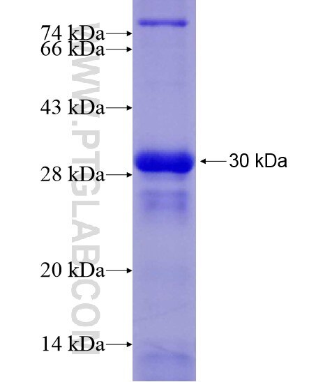 SIK1 fusion protein Ag28491 SDS-PAGE