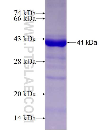 SIK1 fusion protein Ag10954 SDS-PAGE