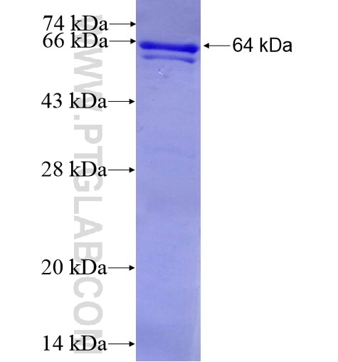 SIK1 fusion protein Ag10984 SDS-PAGE