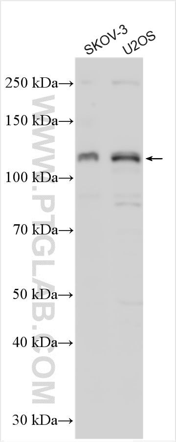 Western Blot (WB) analysis of various lysates using SIK2 Polyclonal antibody (27608-1-AP)