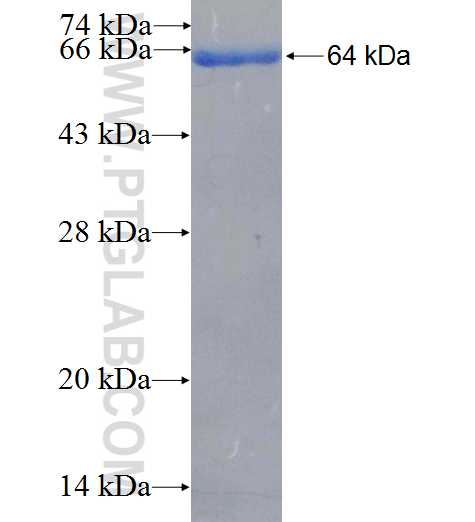 SIK2 fusion protein Ag26468 SDS-PAGE